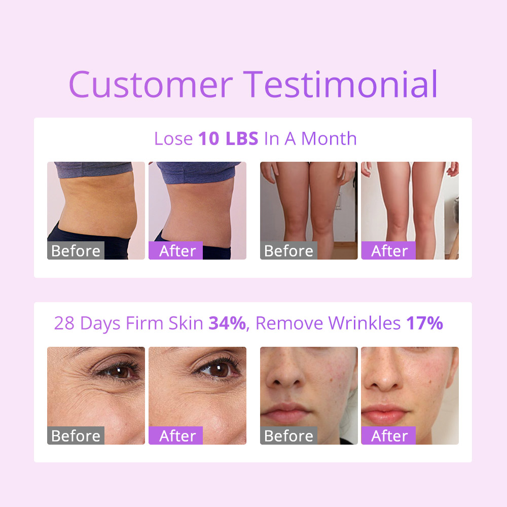 ARISTORM S Shape Cavitation Machine Body Sculpting Facial Anti-Aging Skin Tightening for Startup Beauty Salons